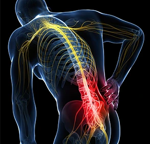 nerve pain on the back